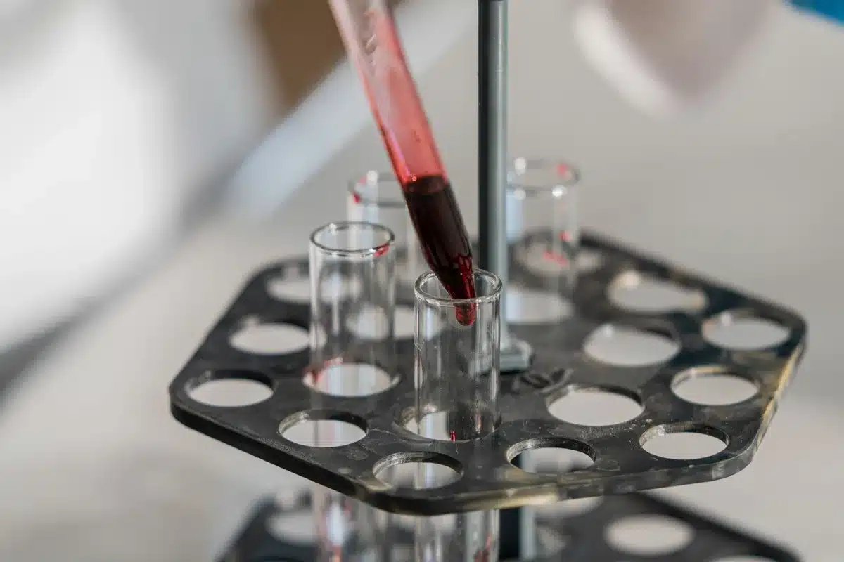 Scientist examining blood plasma samples in a laboratory setting for microbiome analysis