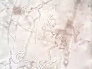 Microscopic view of intestinal tissue and microorganisms in laboratory setting