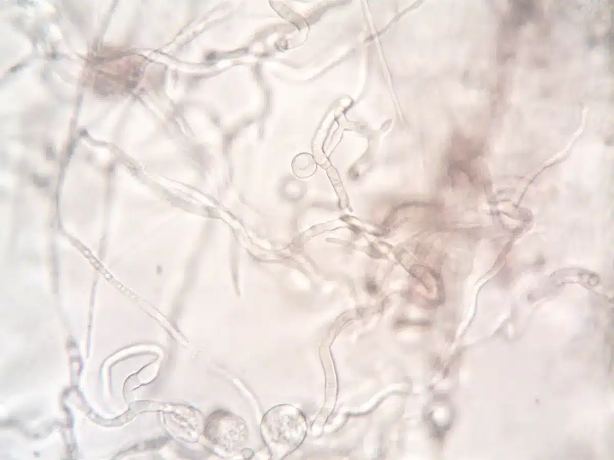 Microscopic view of intestinal tissue and microorganisms in laboratory setting